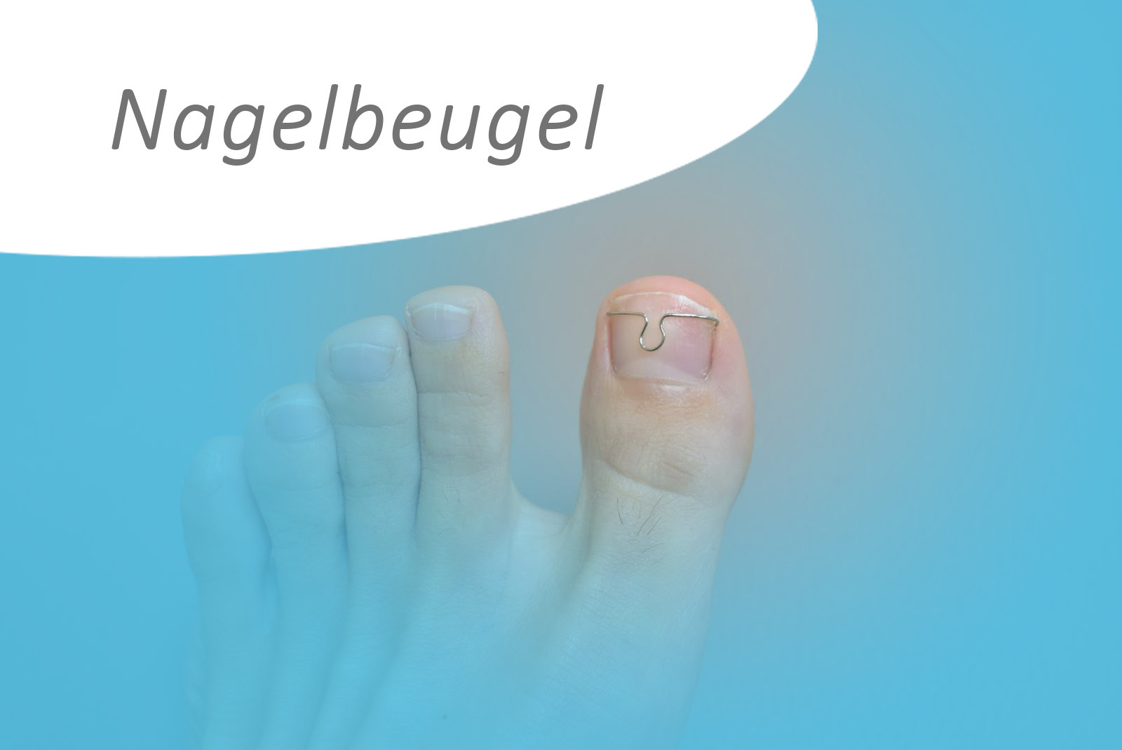 Nagel problematiek